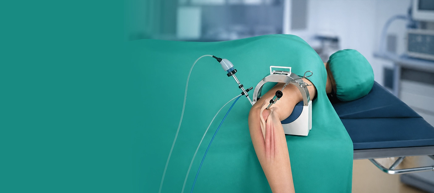 Elbow Arthroscopy Surgery: Cost, Risks & Recovery Timeline